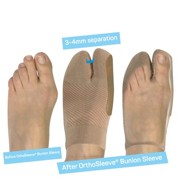 BUNION BRACE NATURAL  L/XL